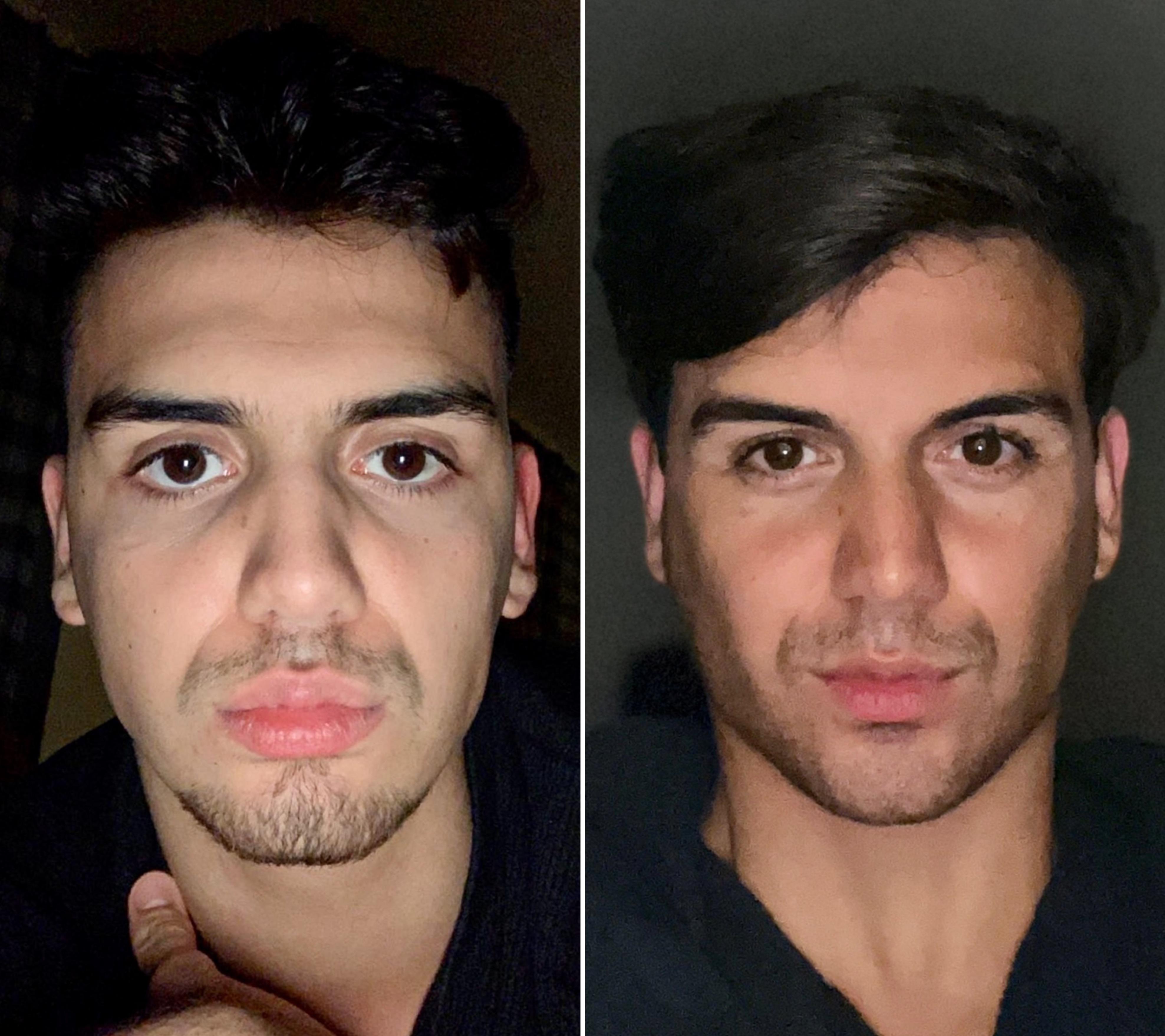 How to Do Mewing: A Guide to Transforming Your Jawline and Facial Stru