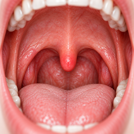 Uvula Swollen From Snoring