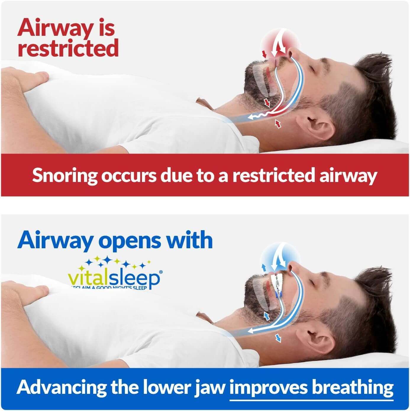 Side profile of man’s airway with and without VitalSleep