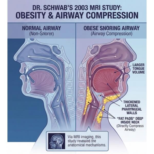 The Anatomy of Airway Collapse