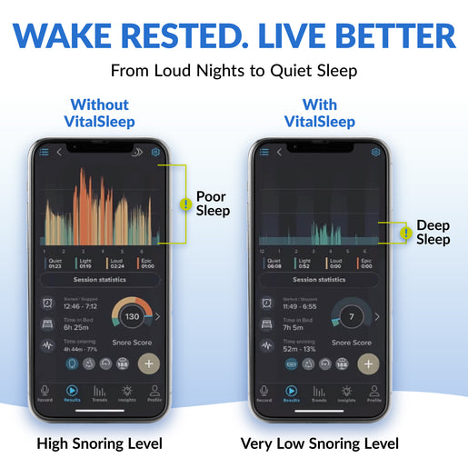 Graph from the Snorlap app showing a user's snoring reduction data after using a snoring mouthpiece