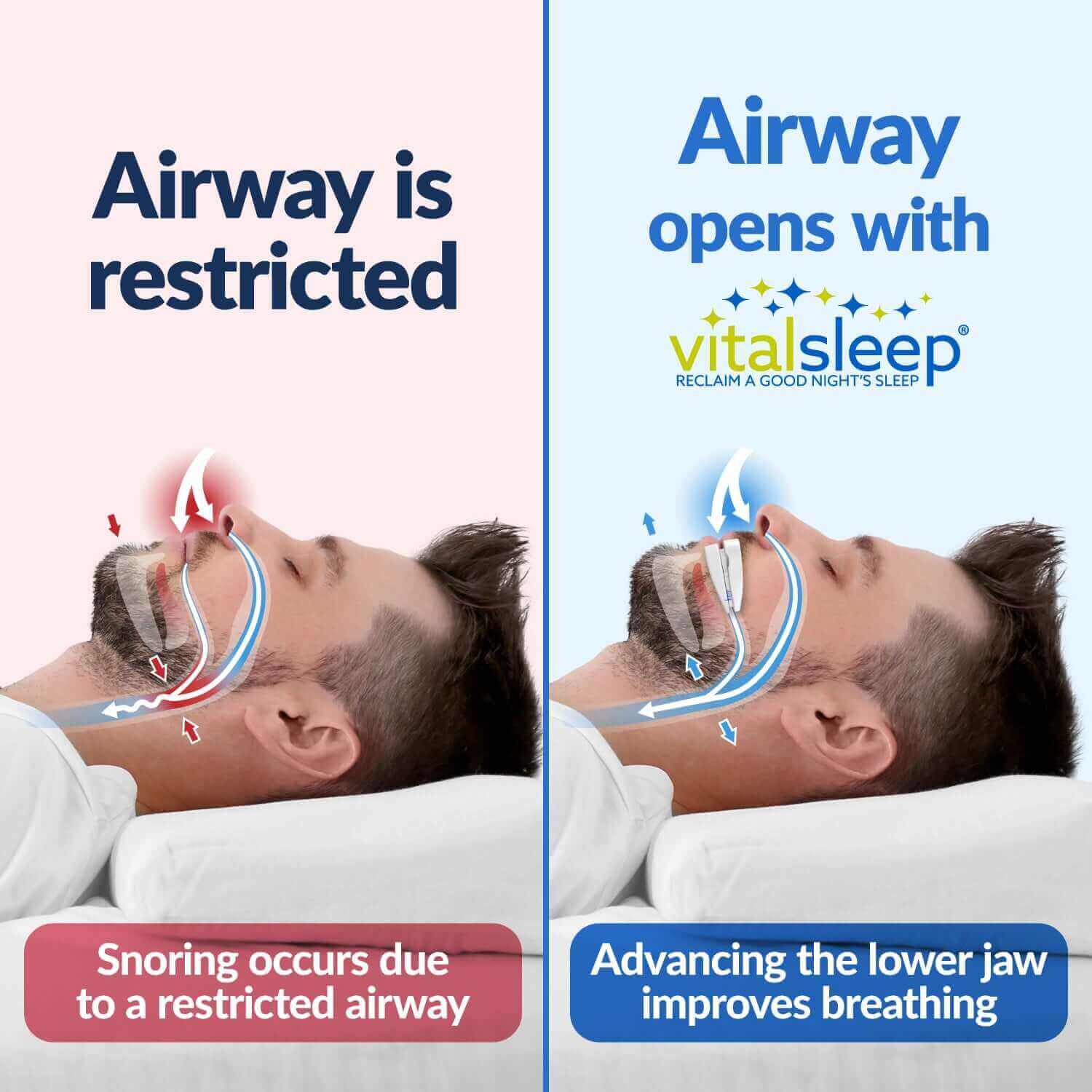 2 VitalSleeps - FREE OAP Cleaner, Brush & 2 Sleep Masks