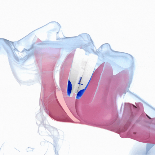 anatomical view airway opening with snore guard