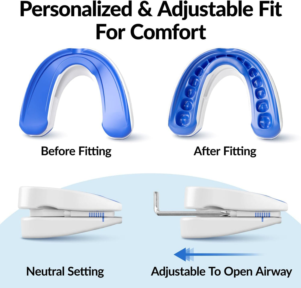 Before and after fitting of a blue dental device with adjustable features on a white background.