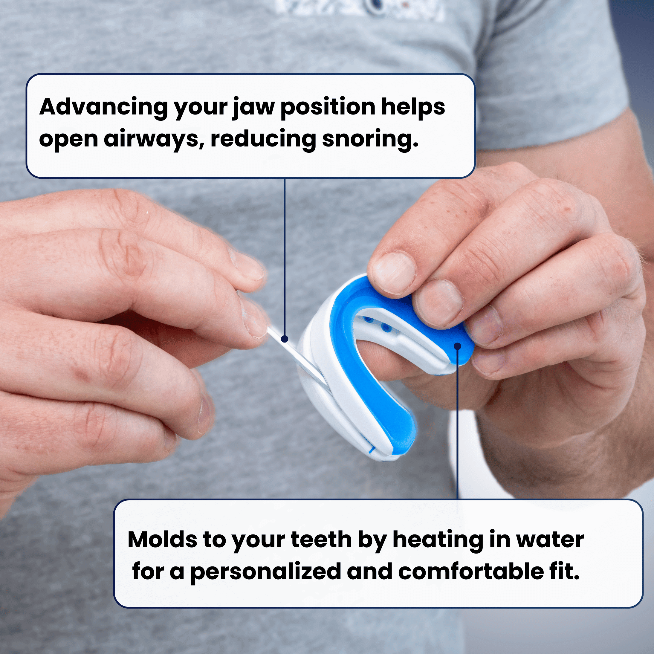 Custom-fit anti-snoring mouthguard with Accu-Adjust system